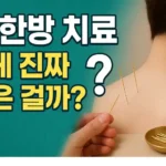 금 한방 치료, 몸에 진짜 좋은 걸까?